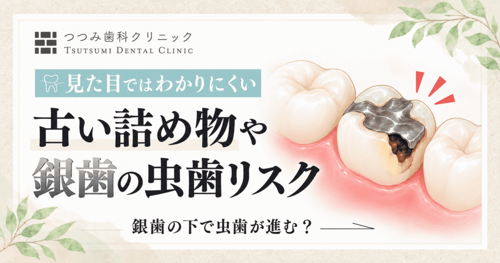 記事画像