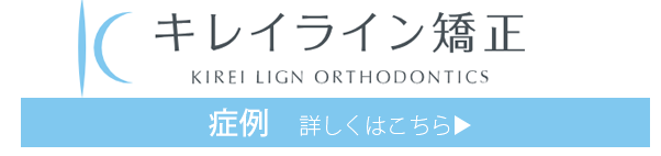 インビザライン専門ページの症例
